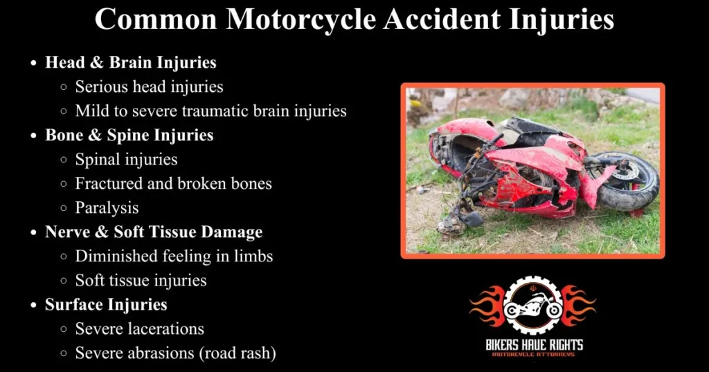 Motorcycle Injuries Infographic